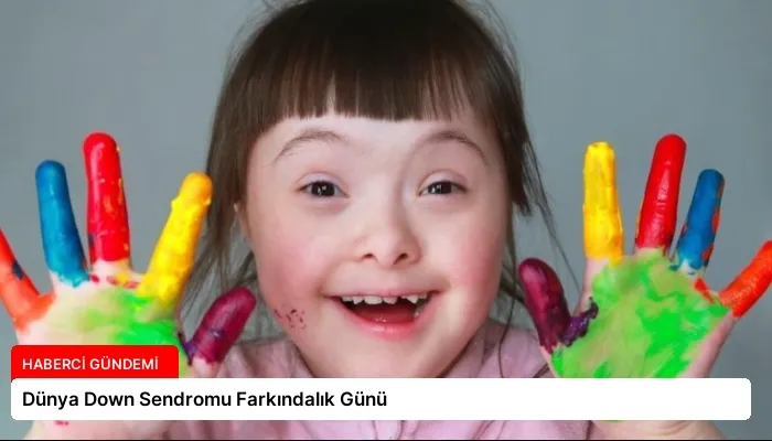 Dünya Down Sendromu Farkındalık Günü