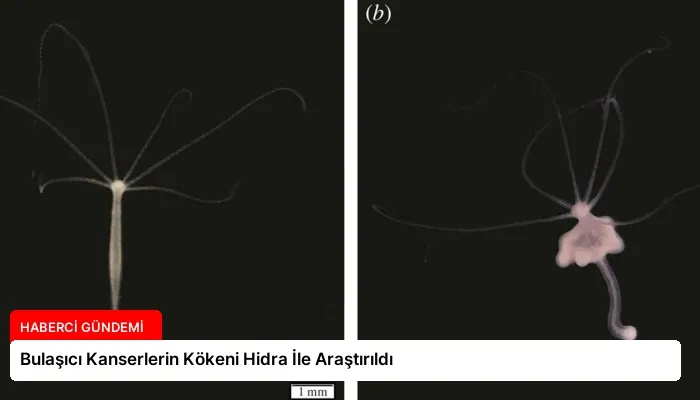 Bulaşıcı Kanserlerin Kökeni Hidra İle Araştırıldı